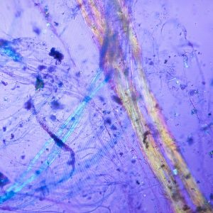 Nærbillede af et mikroskopbillede på skærm, hvor lange, regnbuefarvede asbestfibre ses som tynde, glimtende tråde på violet baggrund, omgivet af små partikler og mikroskopisk støv